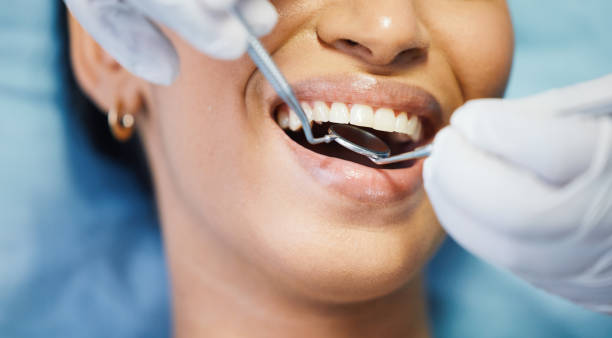 Best Broken or Cracked Tooth Emergency Dentist in University Place, WA